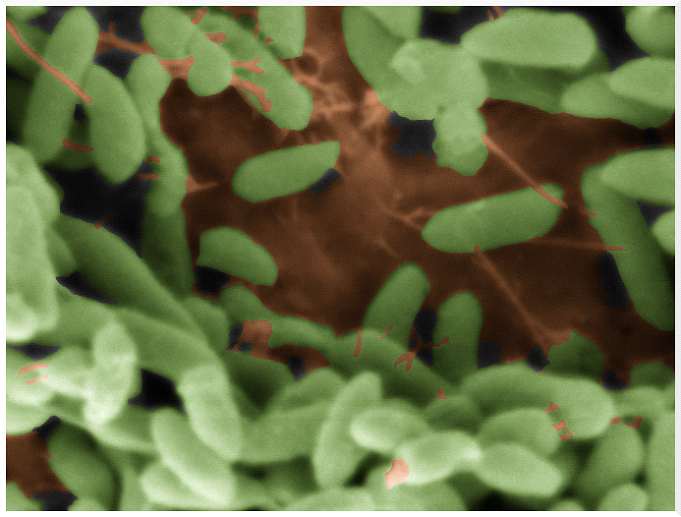 Prévention des intoxications par la bactérie pathogène : Bacillus cereus